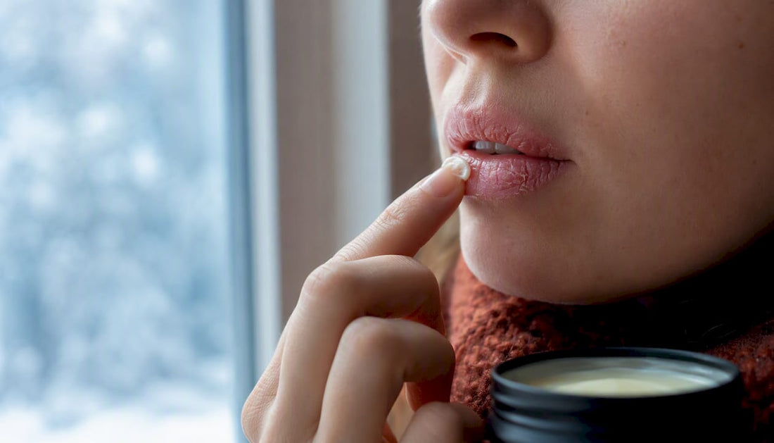 Applying balm to dry chapped lips