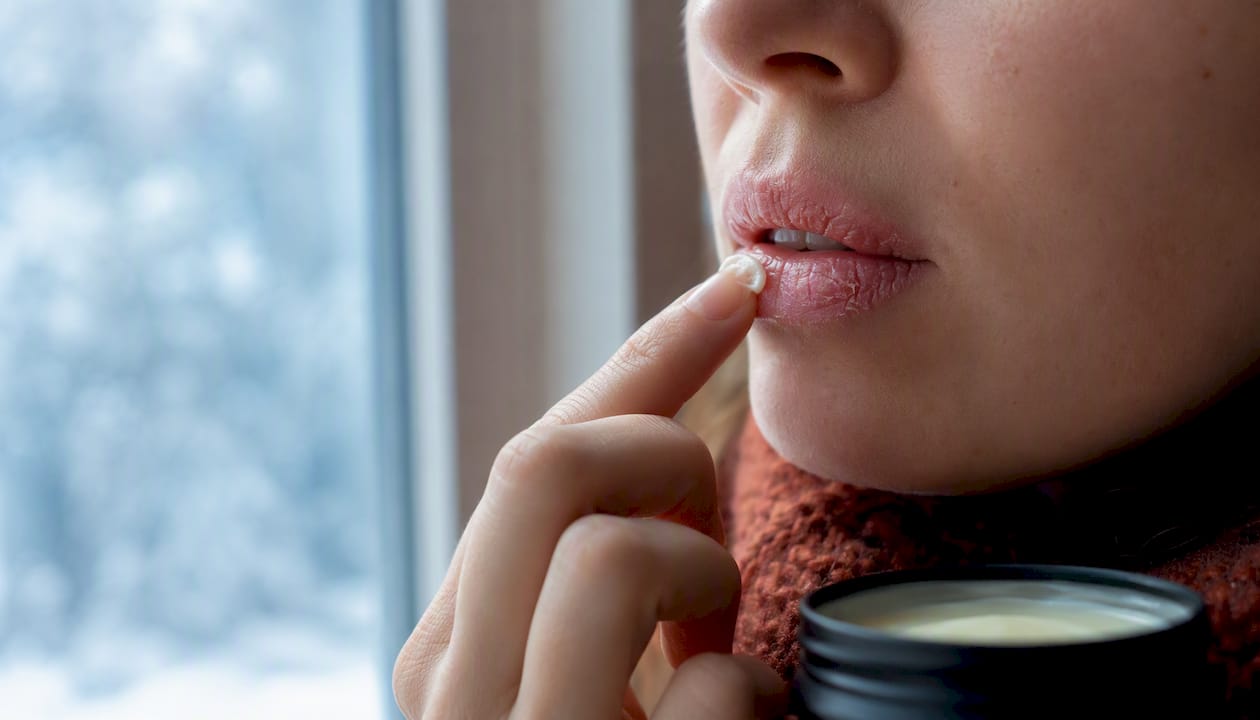 Applying balm to dry chapped lips